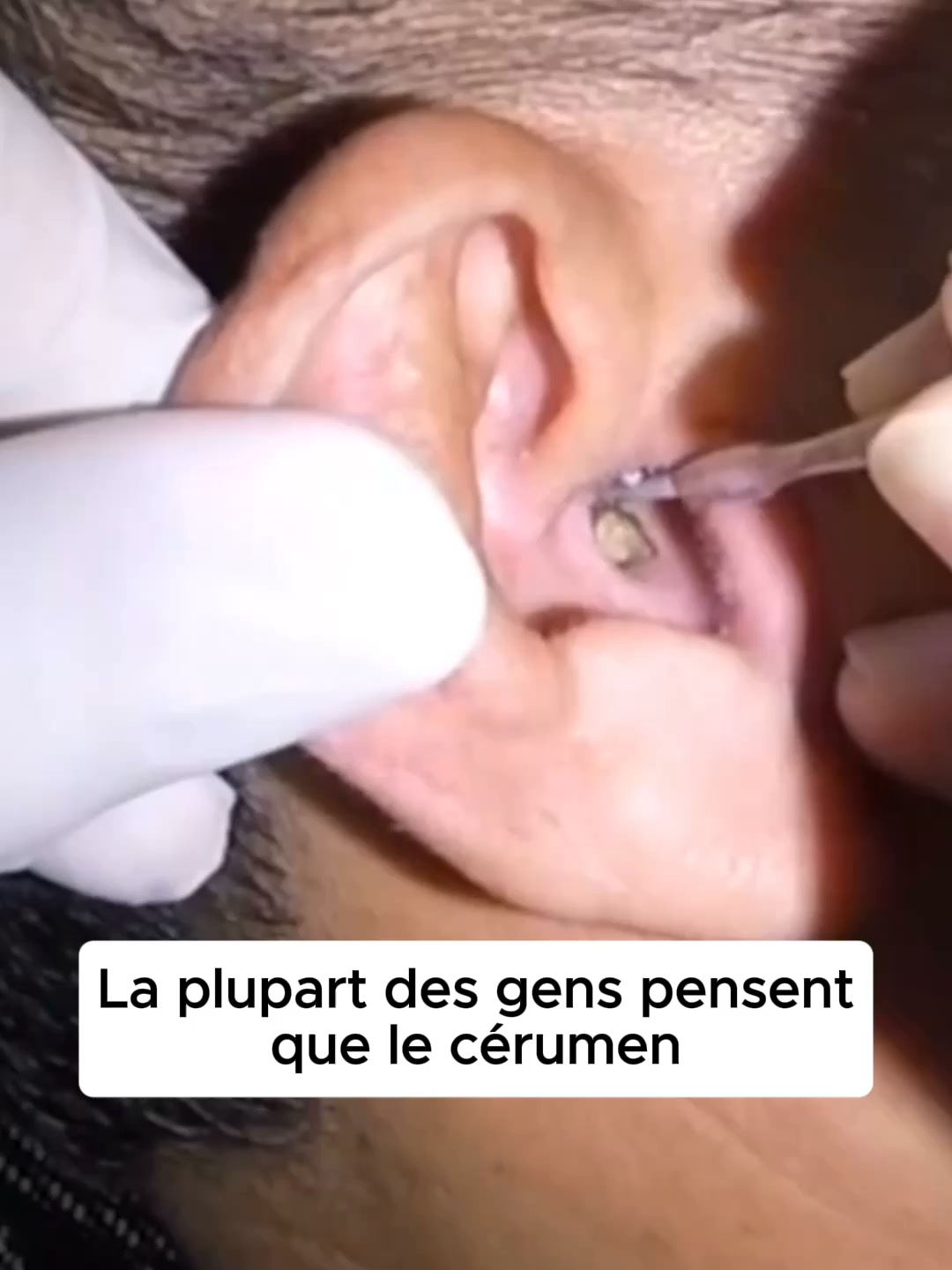 Oreilles Dégagées, Audition Claire