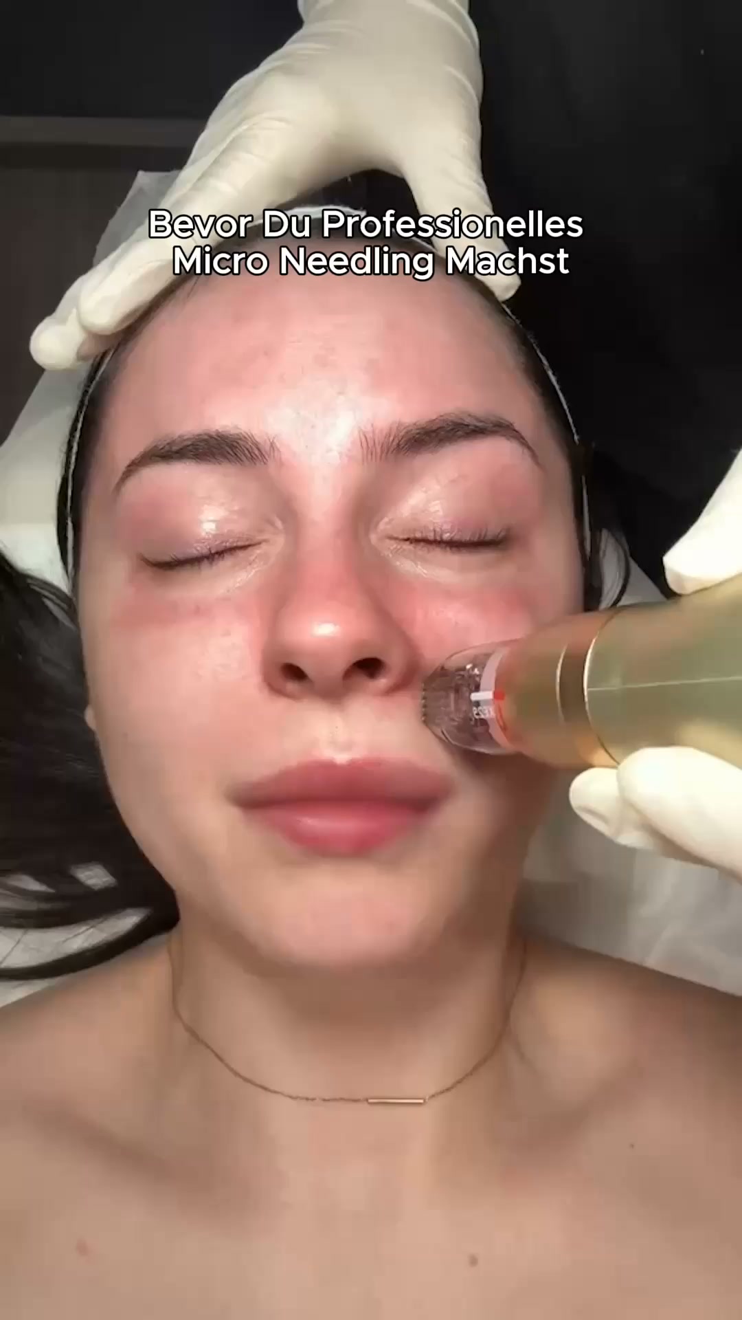 Bye, Bye Anti Aging Routine!