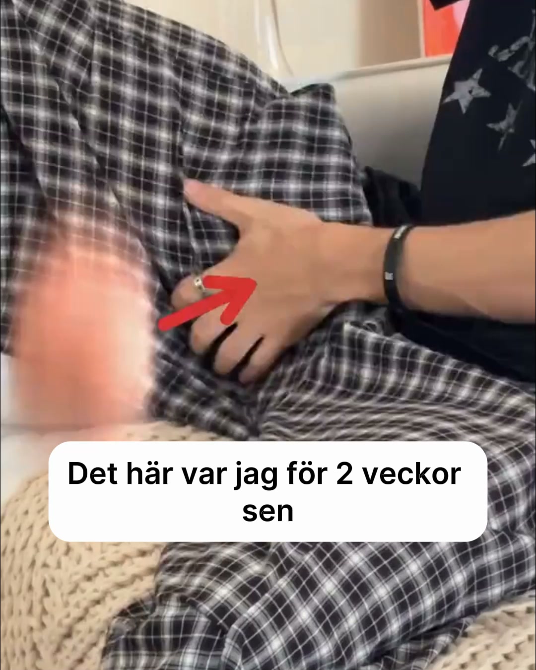 Fri från ljumsksvamp