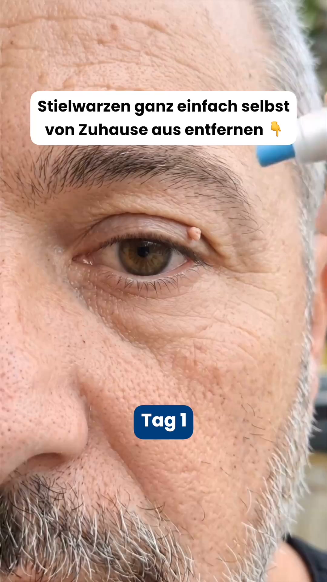 Anúncio de myguy