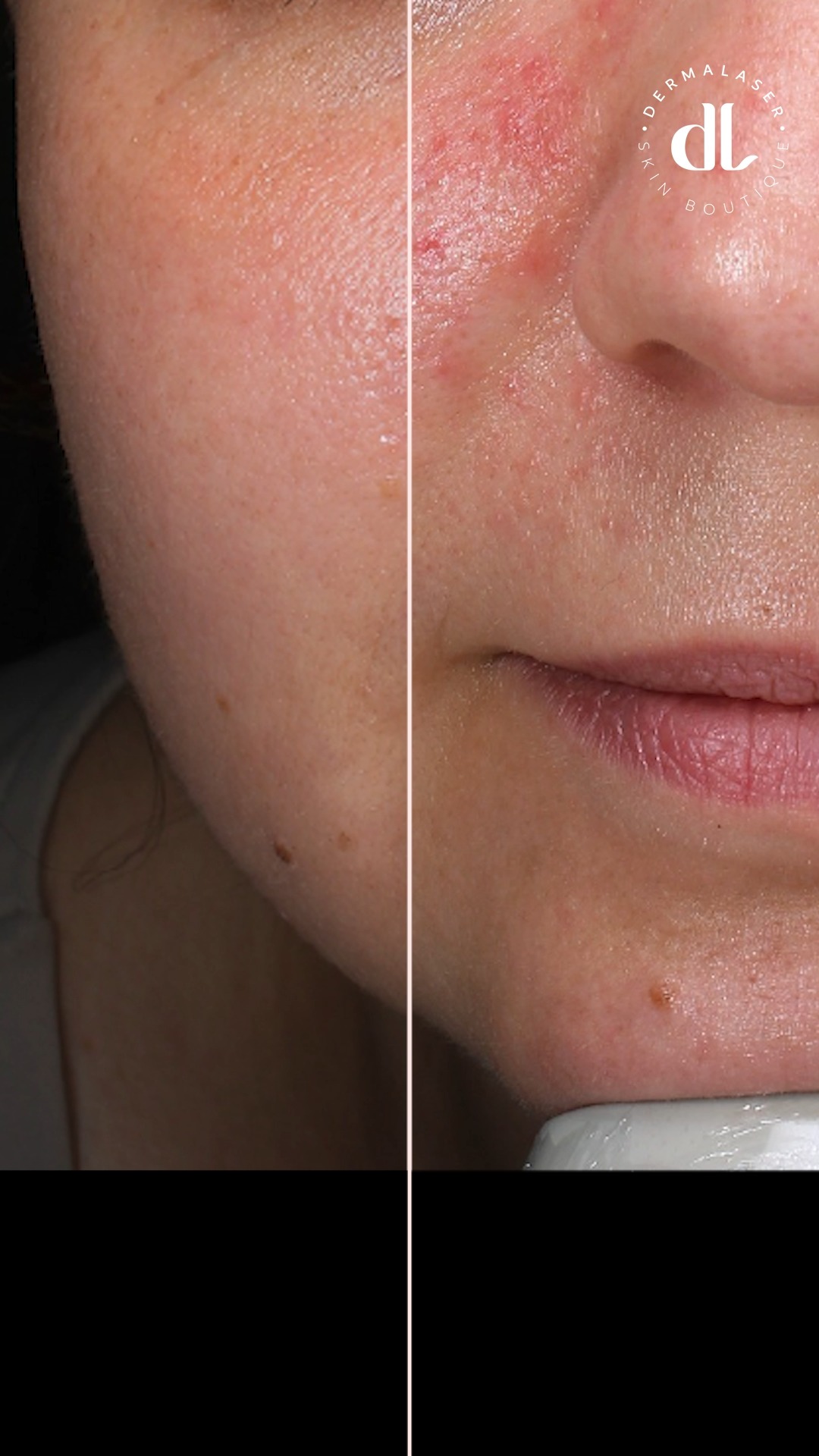 Anúncio de Dermalaser Skin Boutique