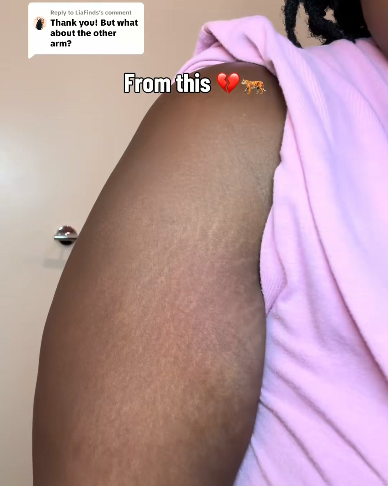 Smoother Skin in 4 Weeks