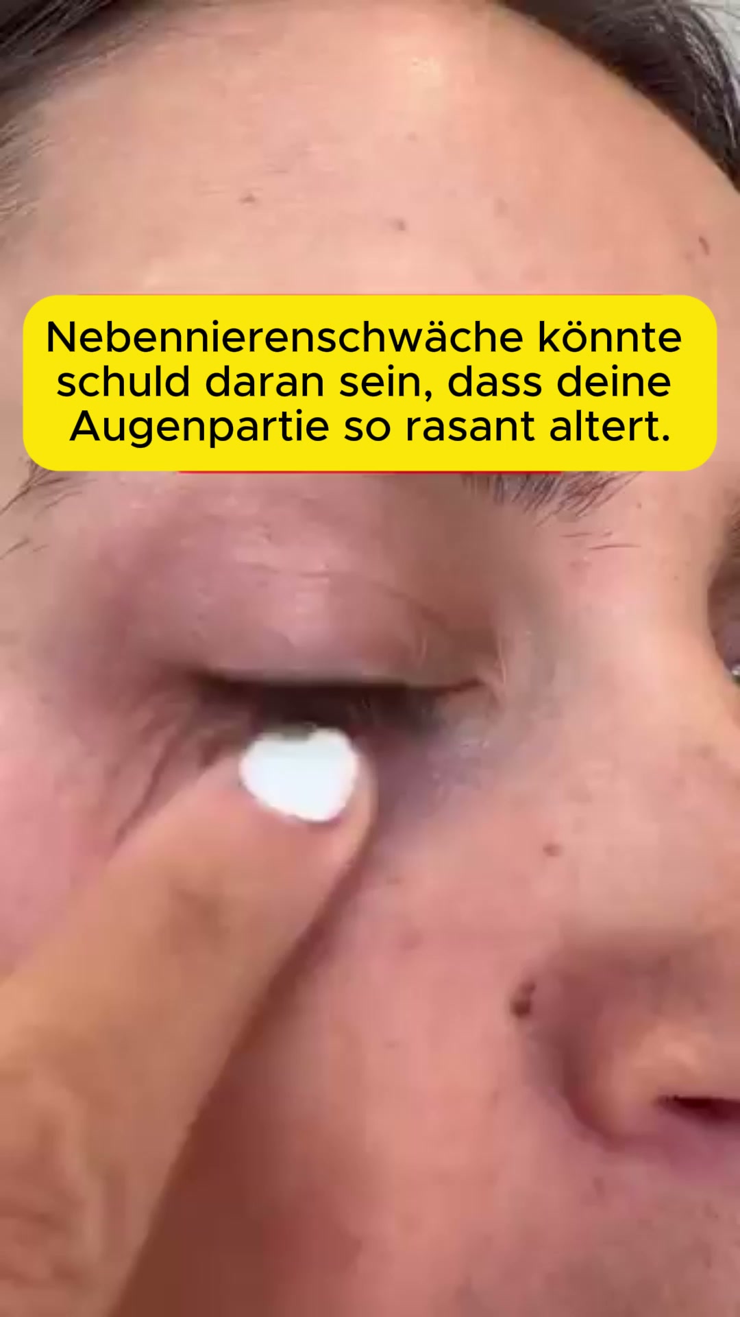 Keine OP. Kein Botox. Keine Filler. Nur Lichttherapie