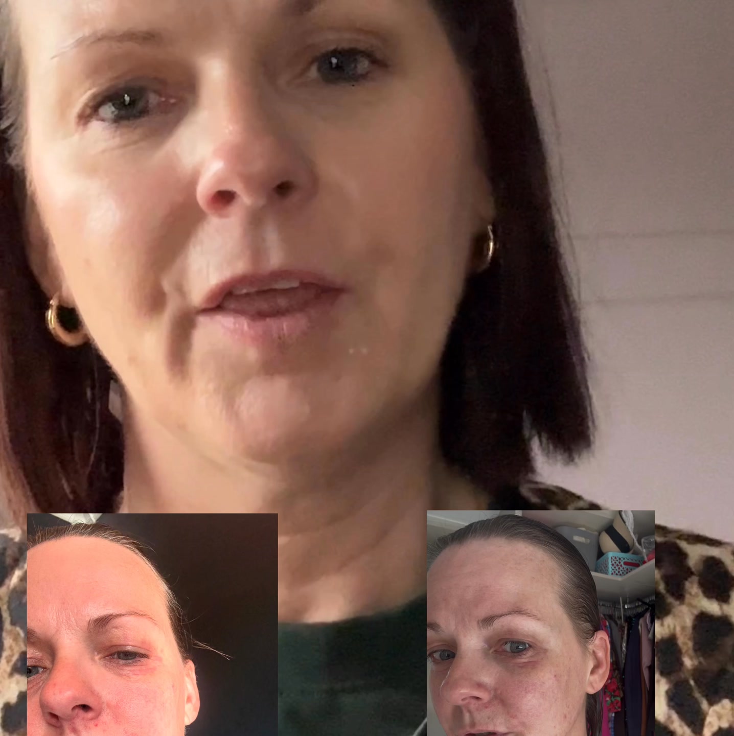 Irish Skincare Trial [Risk-Free]