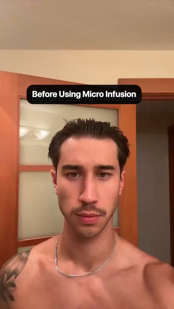 If Your Hair Has Started Thinning, Read This Before You Try Another Product