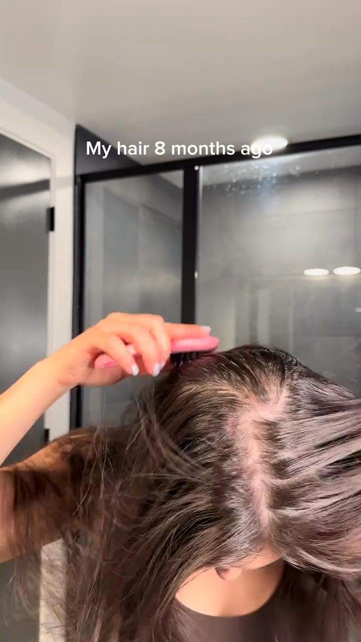 Korea's #1 Hair Growth Serum