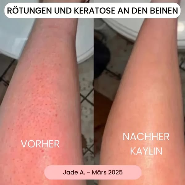 Eine hautschonende Rasur
