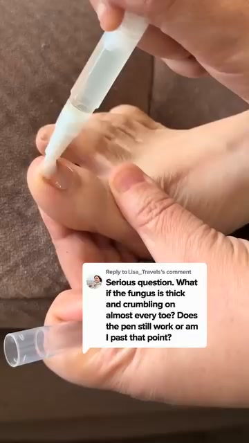 The Real Reason You’re Hiding Feet