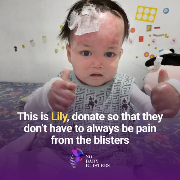 Help Save Baby Lily