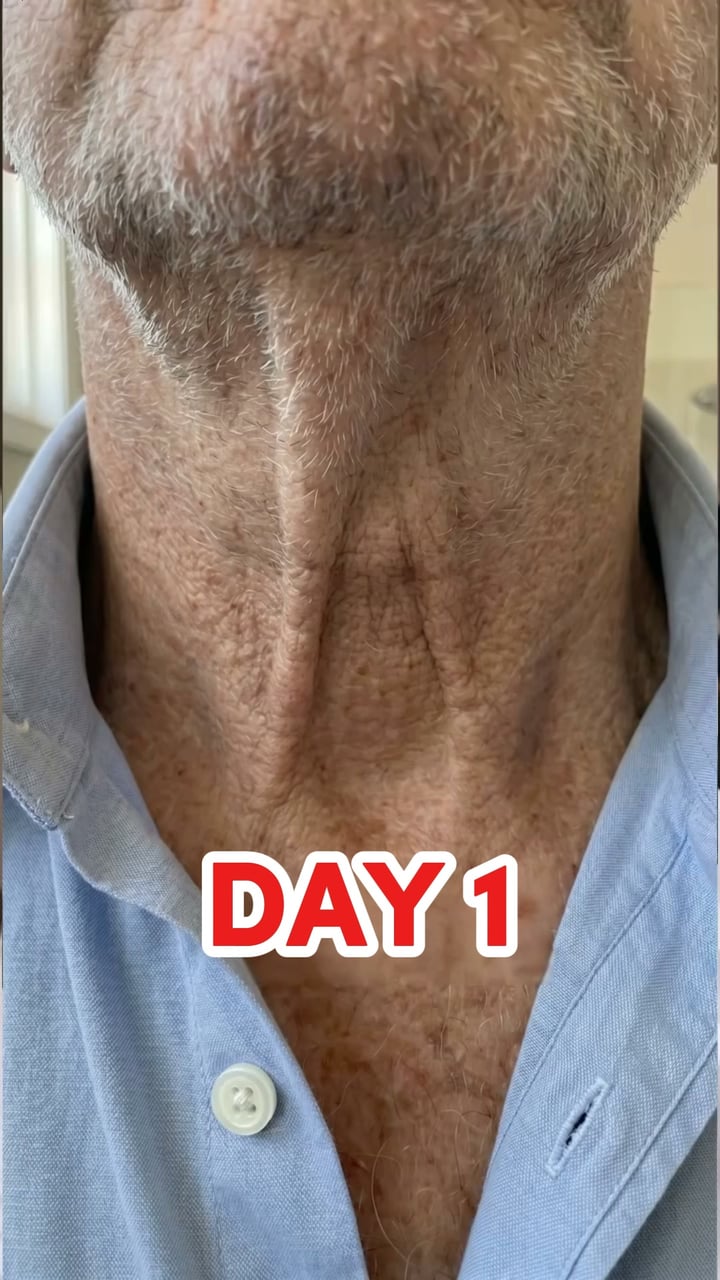 Stronger, more attractive skin