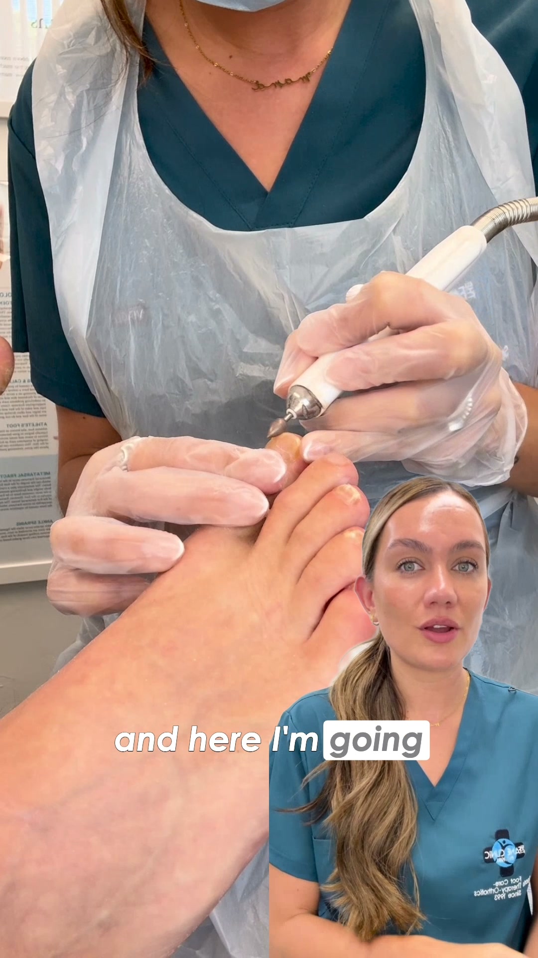 Fungal Nails? Find The Cause