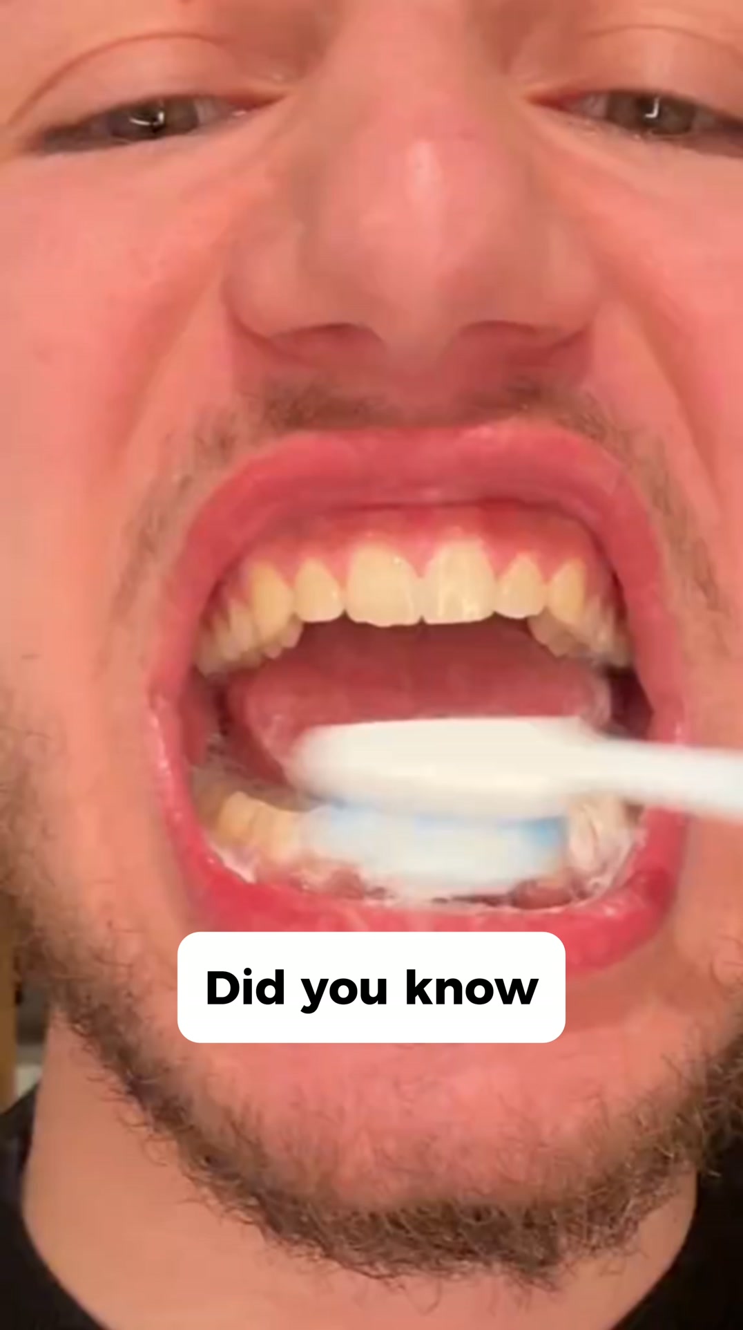 Upgrade to a smarter brushing routine today.
