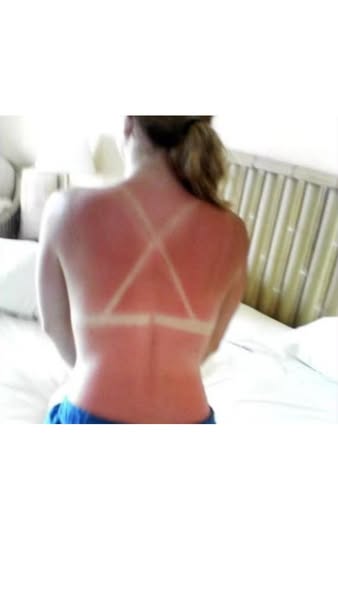 La vérité sur le "bronzage classique"