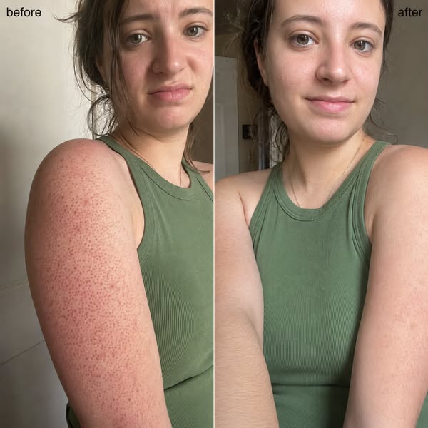 What made her red, bumpy arms look clearer