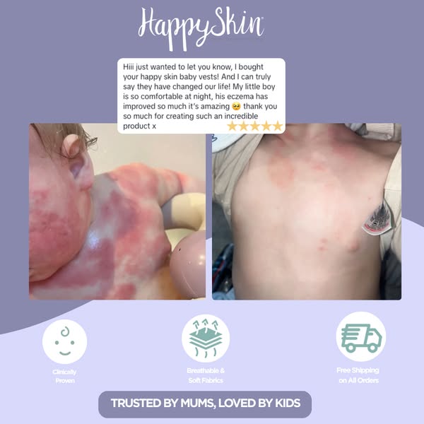 Cool Comfort for Eczema-Prone Skin