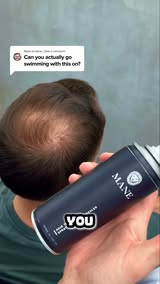 Seeing More Scalp Lately?