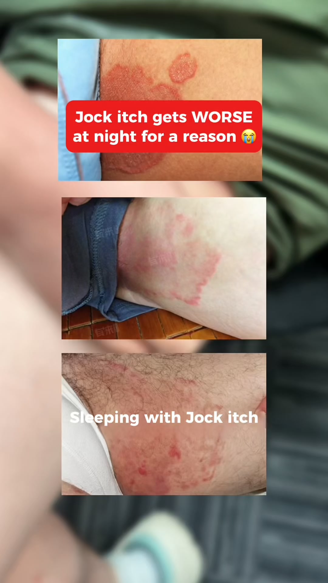 Why Your Jock Itch Keeps Coming Back