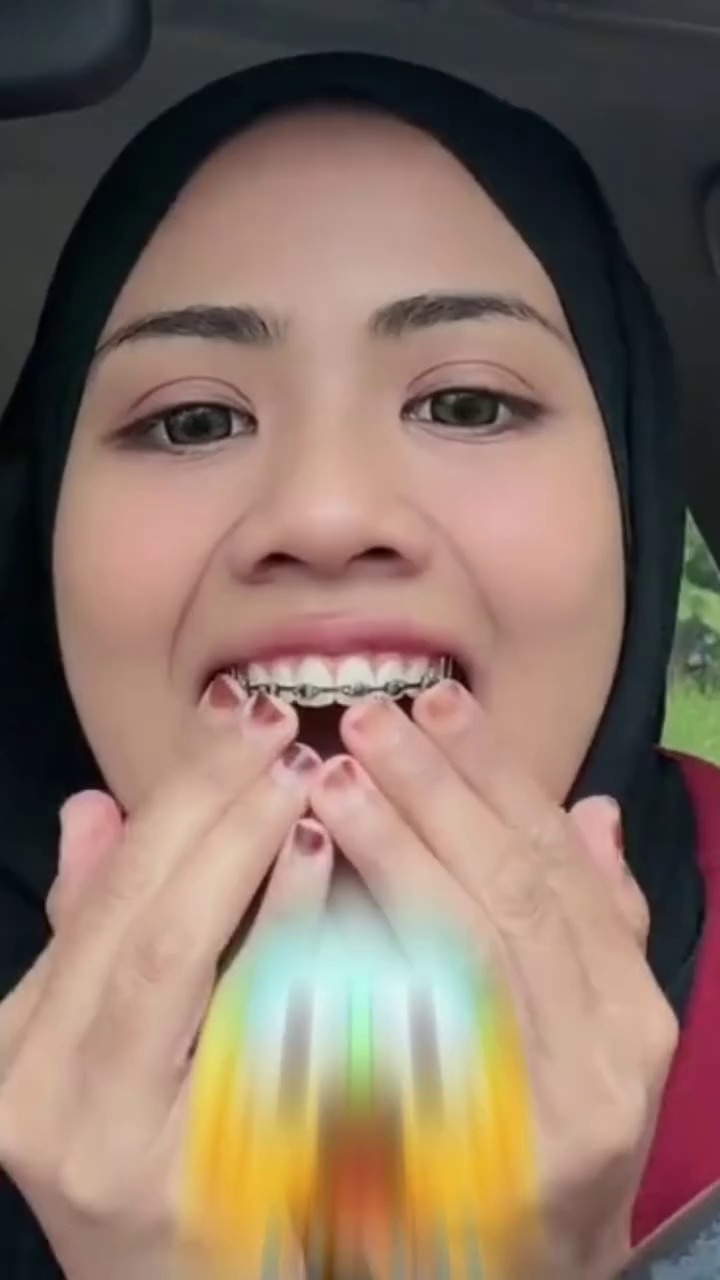 Learn broadly about Top And Bottom Braces!