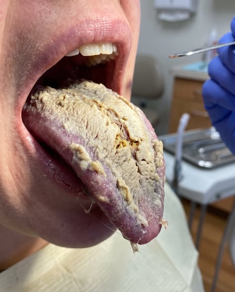 To people who have great hygiene and still can't get rid of bad breath — here's why nothing has worked.