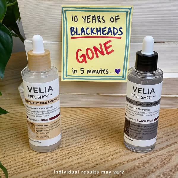 Say goodbye to blackheads