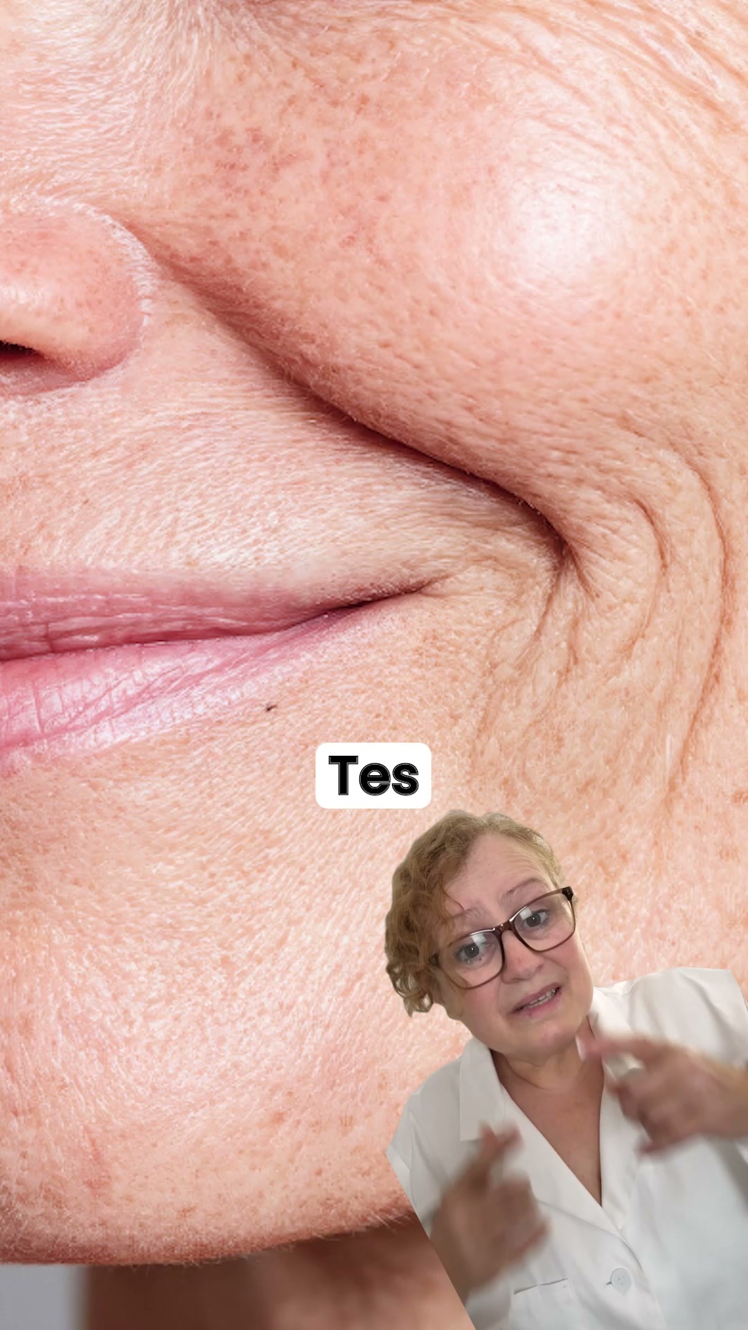 Découvrez le kit de micro-infusion Renovae