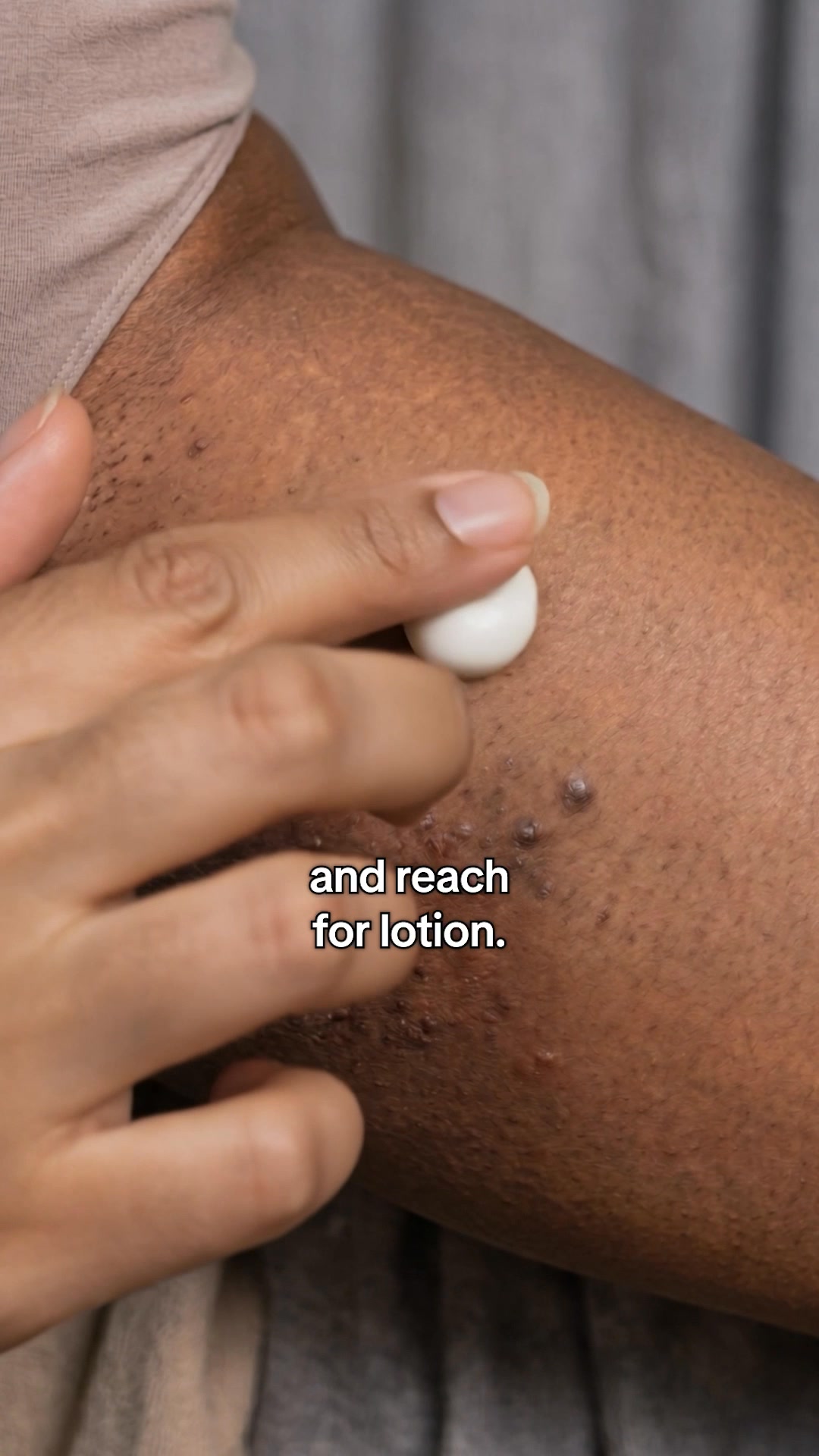 That Dark Patch Is Probably Not Dry Skin