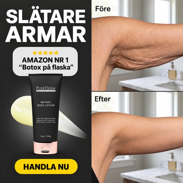 Betala senare med Klarna