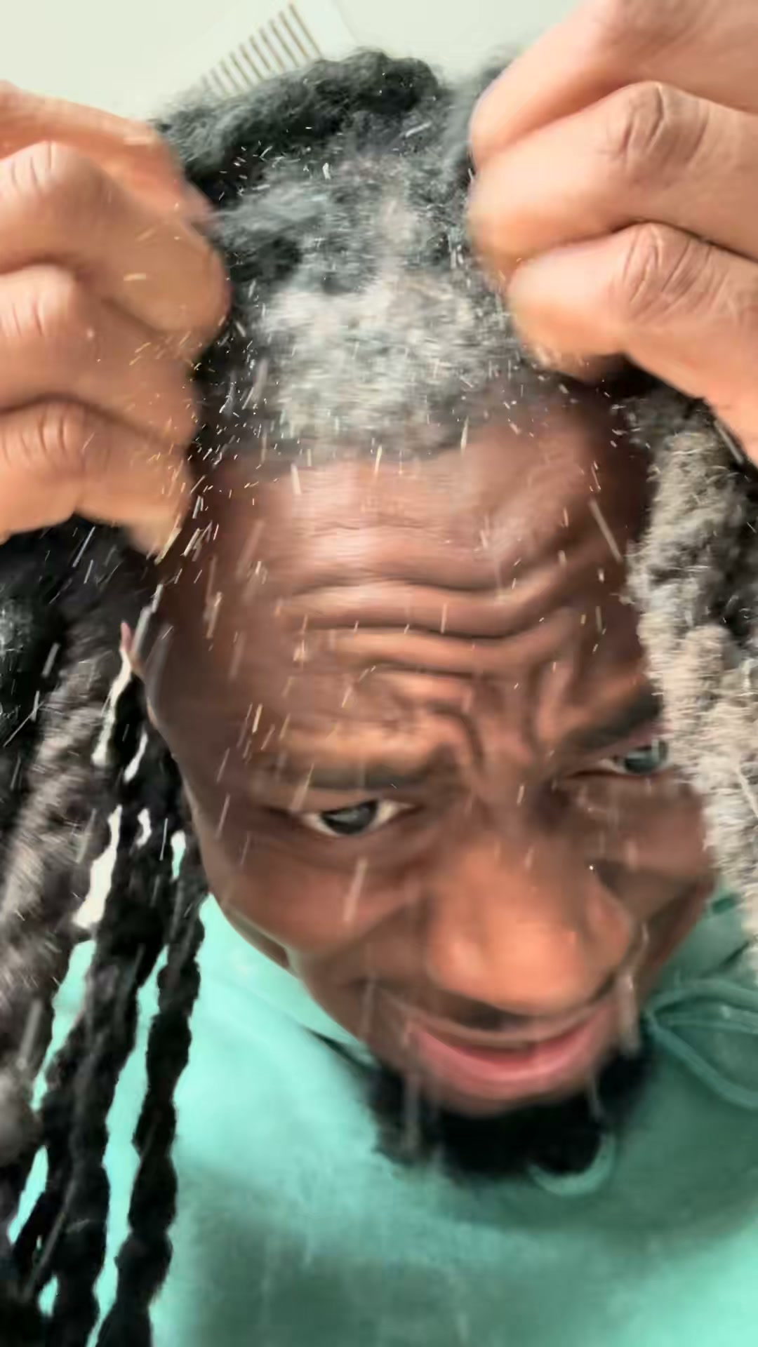 Thought You Were Going Bald? Think Again.