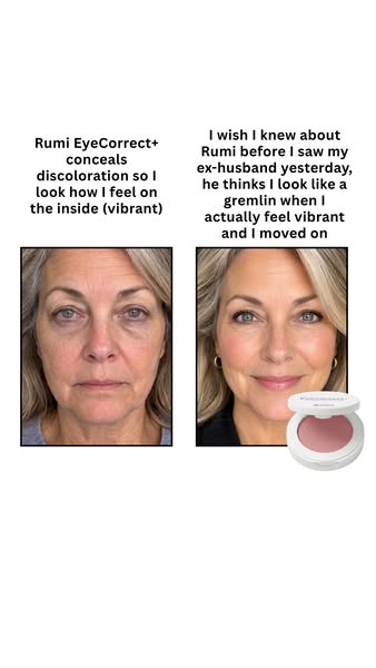 The Under-Eye Fix You've Been Missing