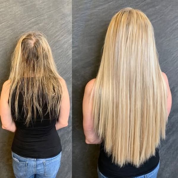 GPs are trained to treat thinning hair and bladder leaks. Not to explain the link.