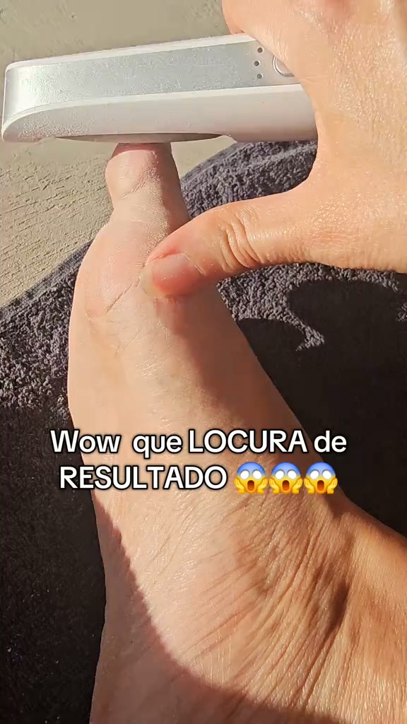 1+1 GRATIS solo hoy