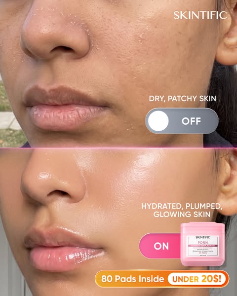 Give Rough, Tired-Looking Skin the PDRN Treatment