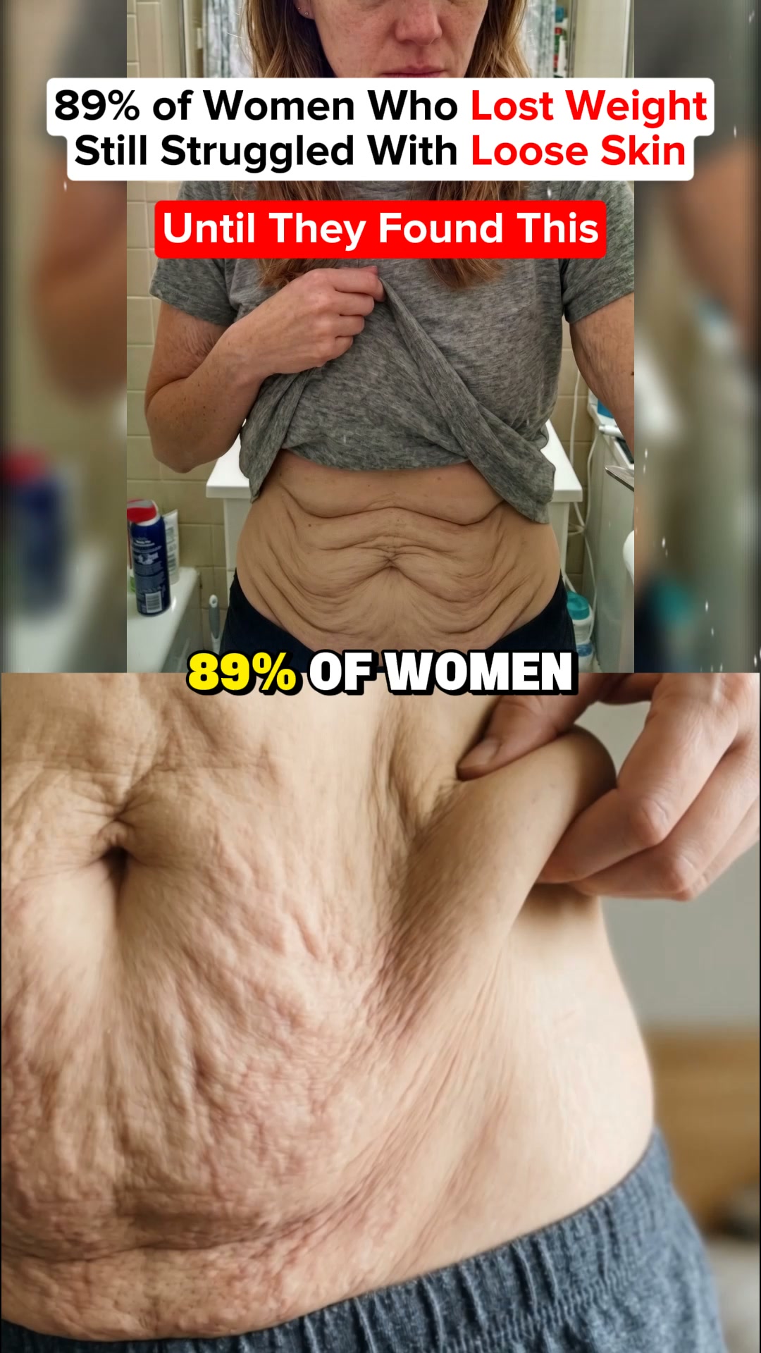The protein collagen can't replace.
