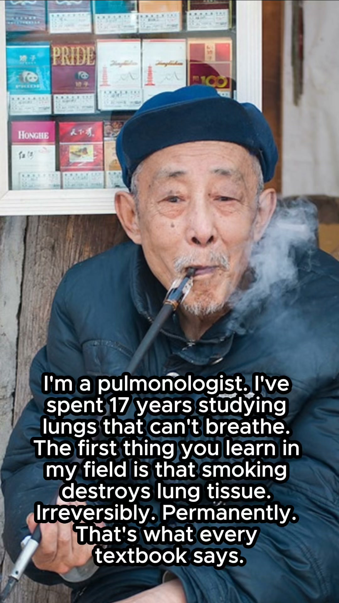 The Japanese Smoker Broke A Pulmonologist’s Belief