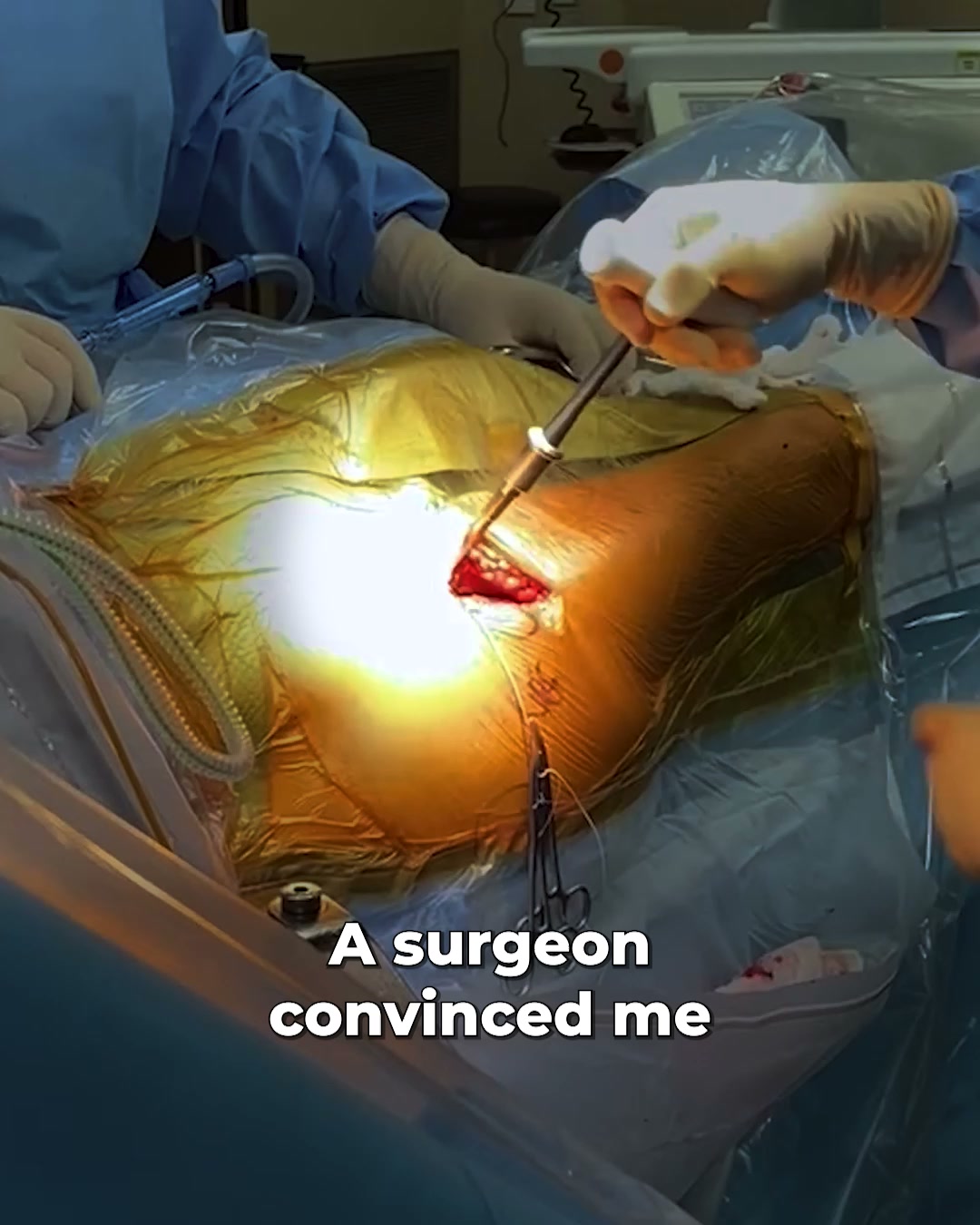 Read This Before Your Sciatica Surgery