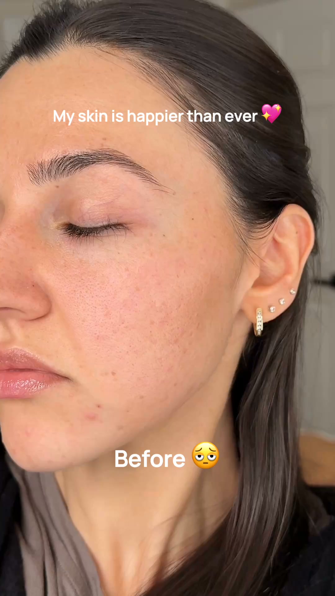$210 | 4-in-1 Longevity Tech for Smoother Skin