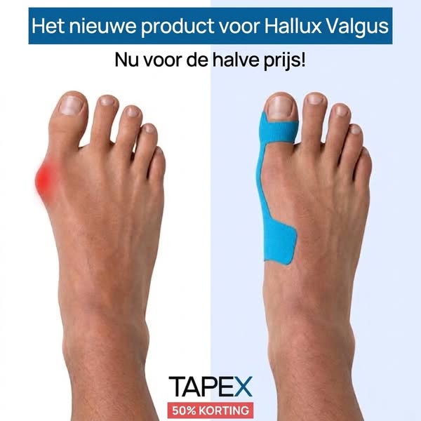 Hallux Valgus Correctie Tape