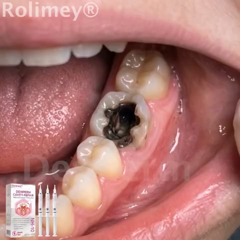 THE DENTAL INDUSTRY IS FURIOUS THIS IS LEAKED!