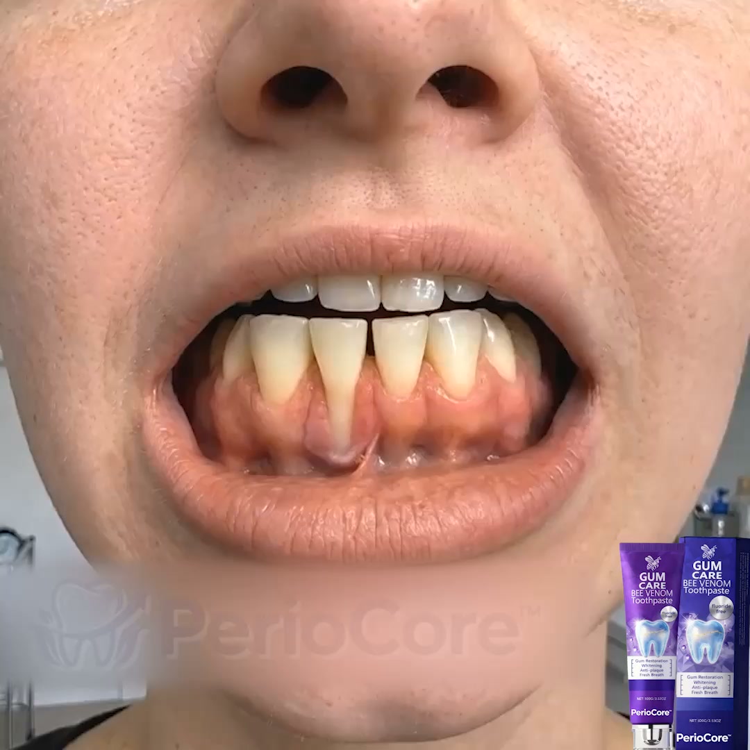 Gum Healing | Endorsed by the British Dental Association (BDA) | Delivery within 2–4 working days | Full Refund Guarantee
