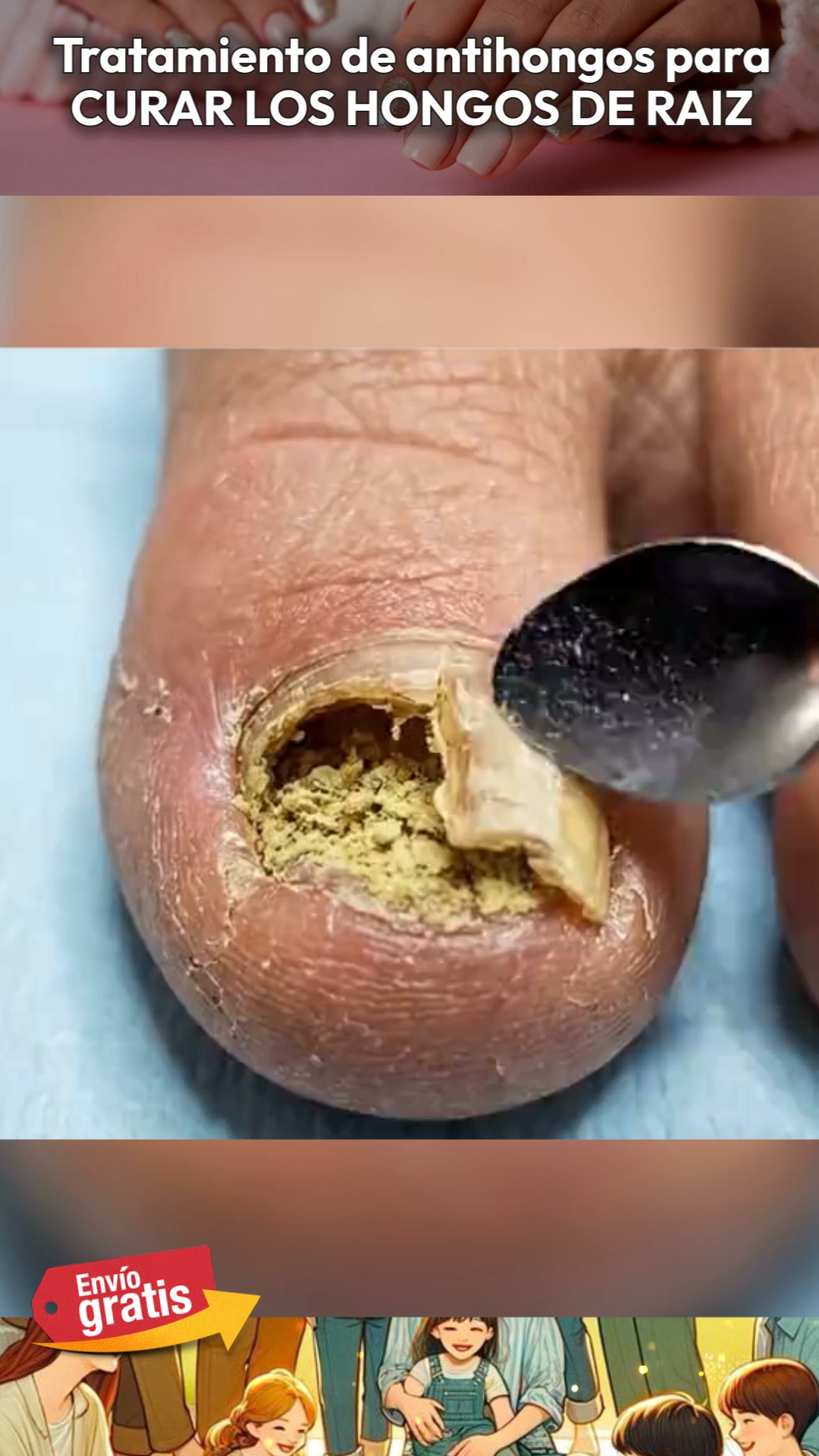 ¿Cuánto más vas a esconder tus pies?