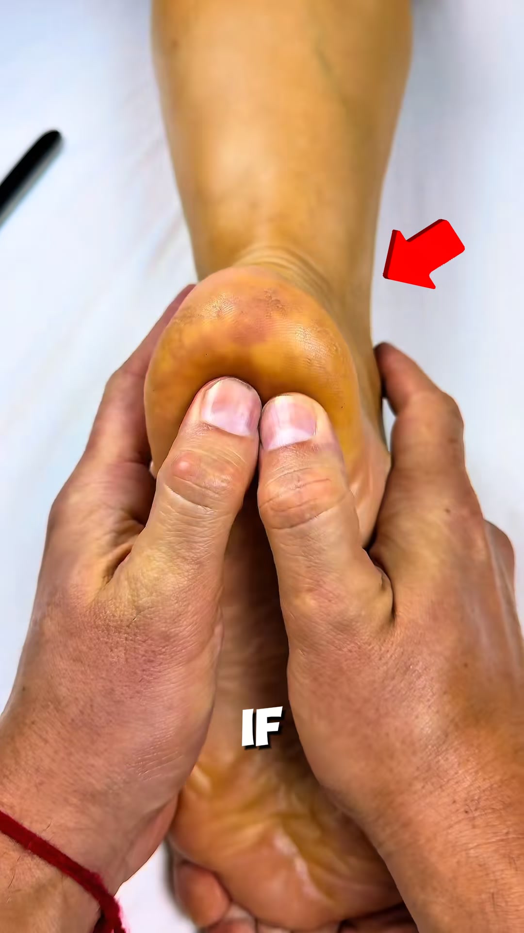 2026's Breakthrough Pain Relief From Plantar Fasciitis