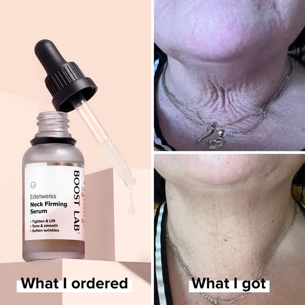 Your Neck Firming Hack