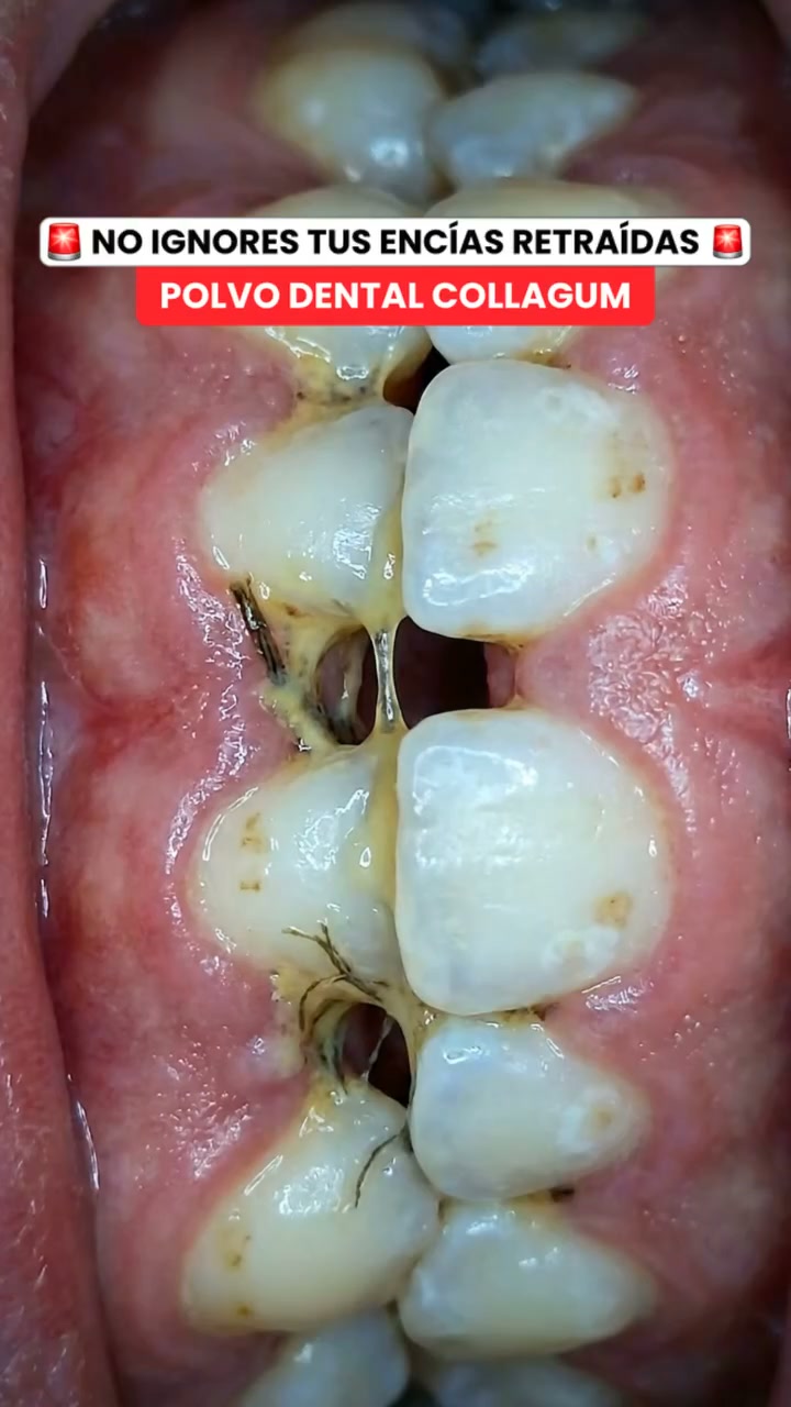 Dale a tus encías el cuidado que merecen”, “ Tu nueva rutina para una sonrisa mejor”, “ Oferta CollaGum: 3 unidades 34,99€” y “ La o