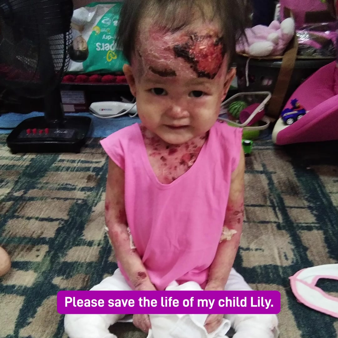 Help Reduce Lily's Pain!