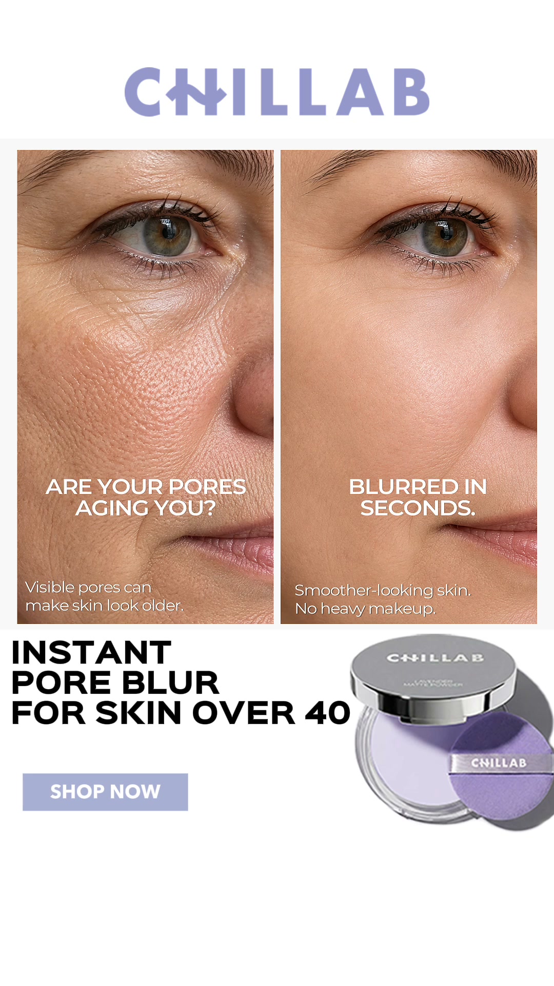 Fresh Skin, No Shine