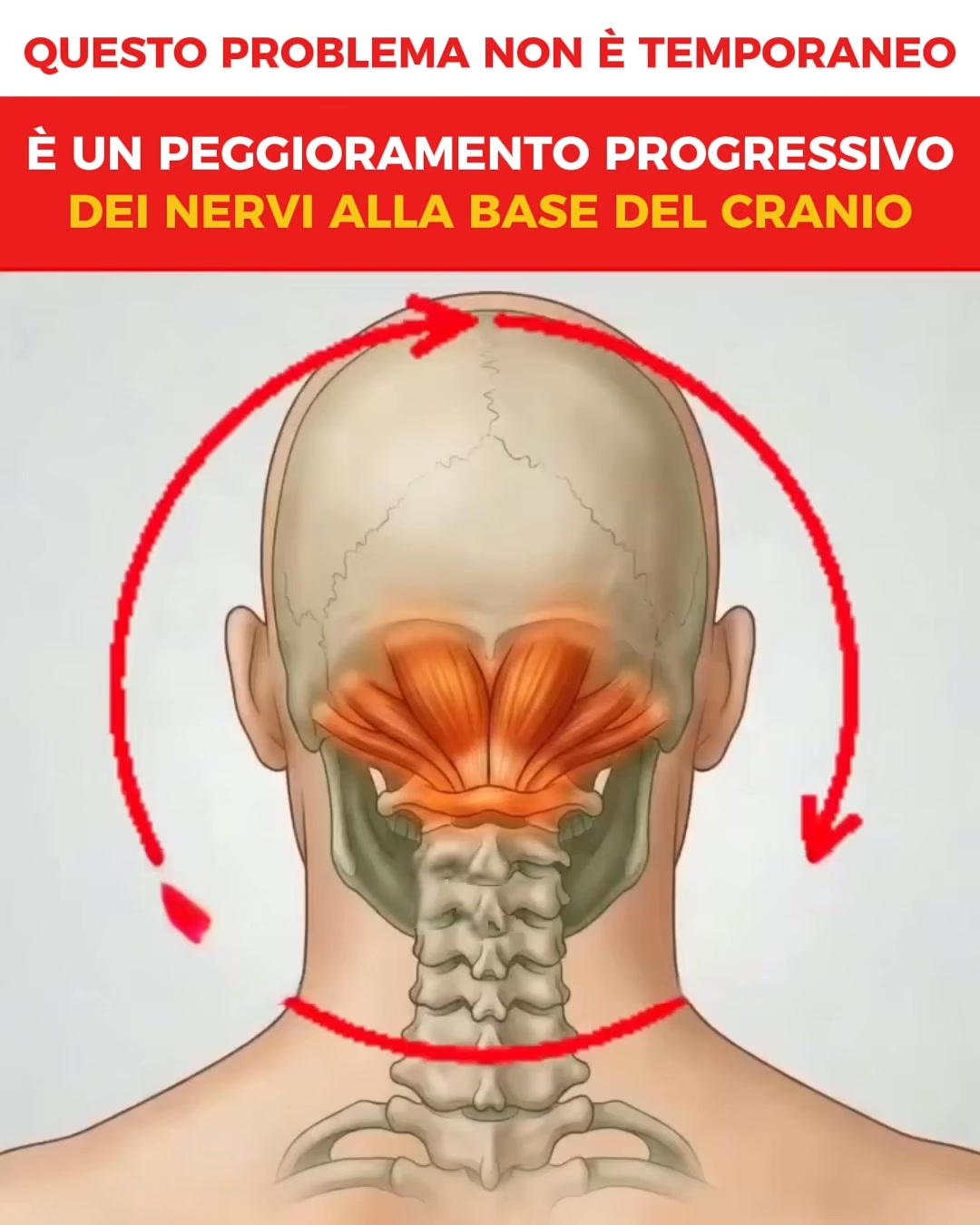 Inizia Lieve, Poi Peggiora
