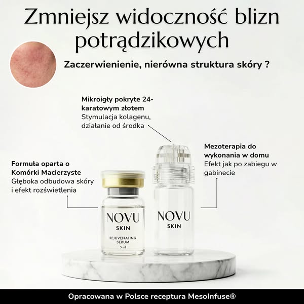 Zaczerwieniona, zmęczona cera? Przywróć jej blask w 10 minut.