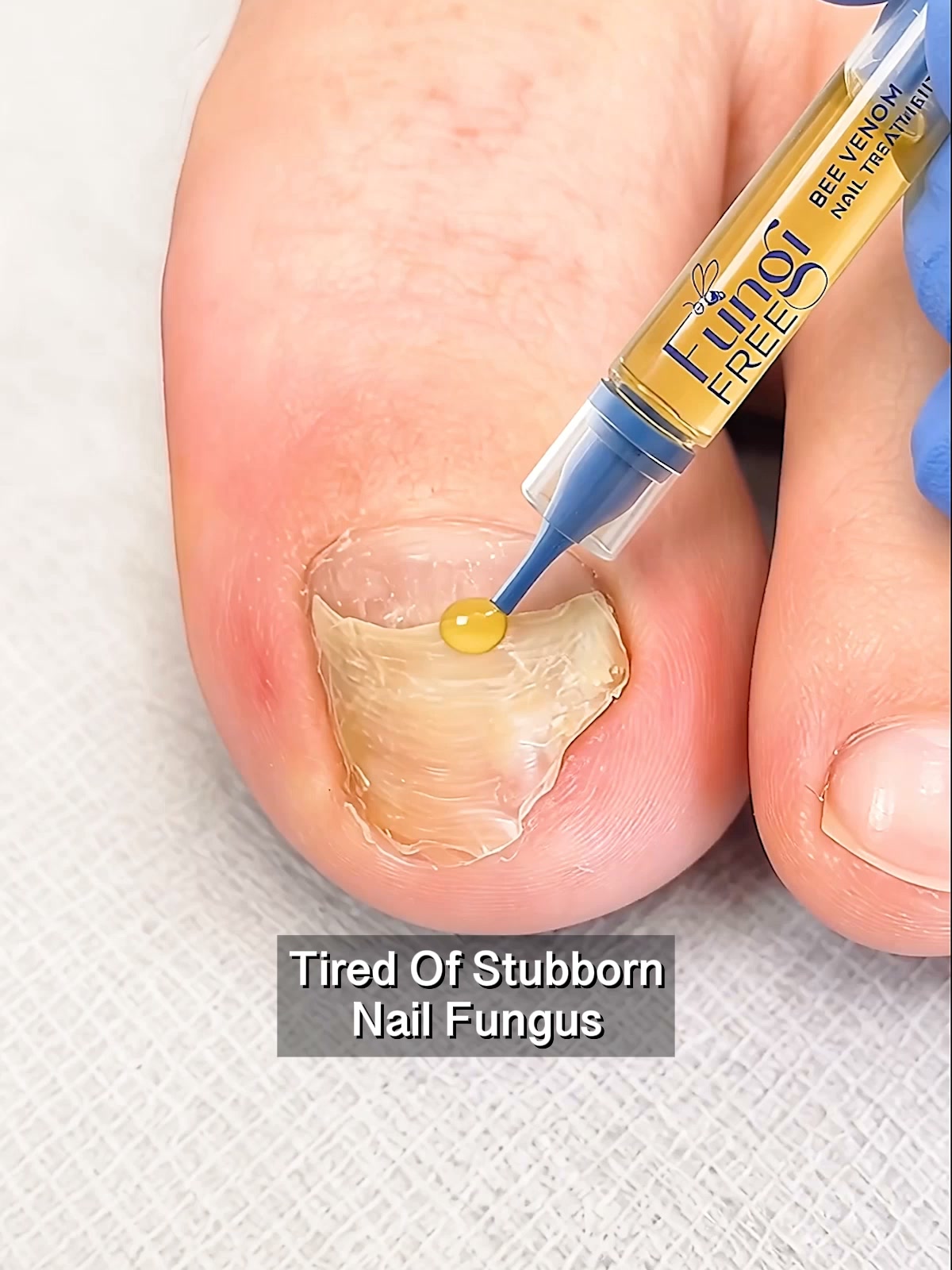 Clear, Healthy Nails from the Root Up