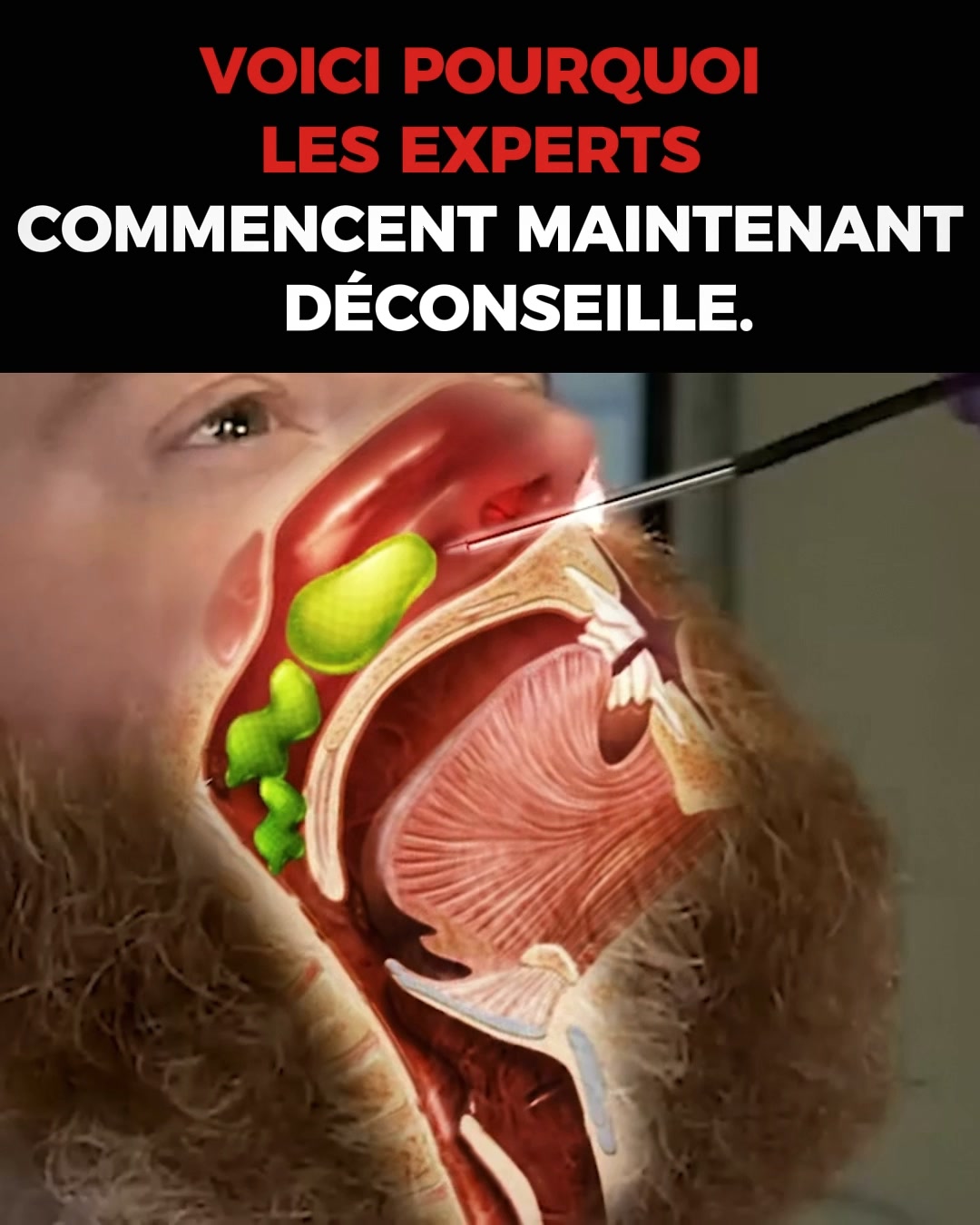 Ronflements : et si vous dormiez enfin mieux ?