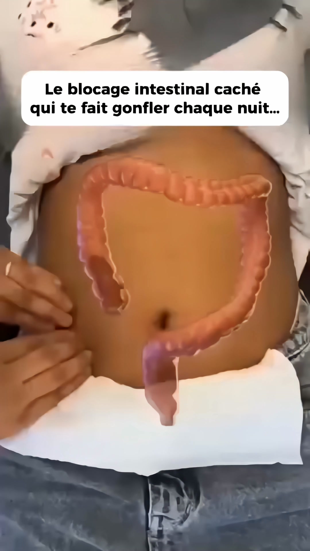 Ballonnements + fatigue ? Ce n’est PAS normal (voici la solution)